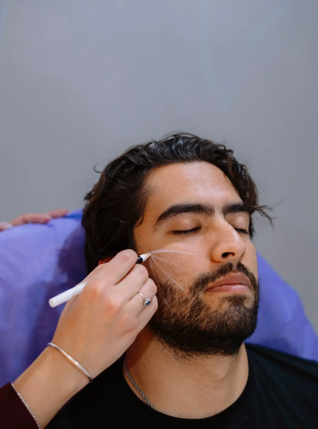 Chirurgie esthétique